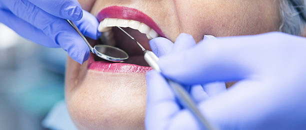 Best Walk-In Emergency Dentist in Thibodaux, LA